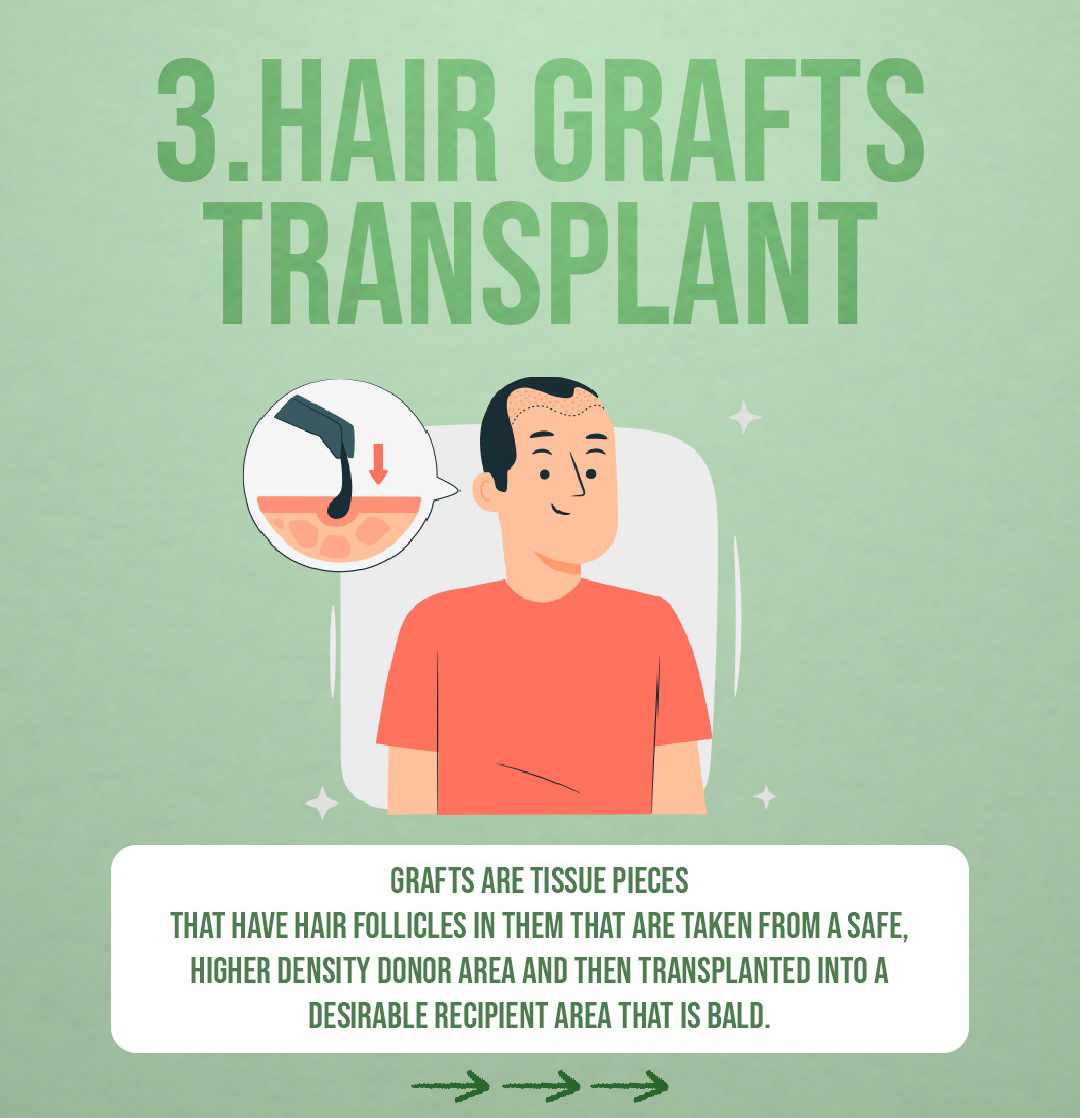 Advance Hair Implant (AHI) Process