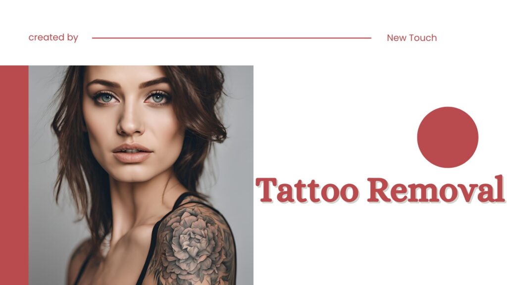 Tatto Removal