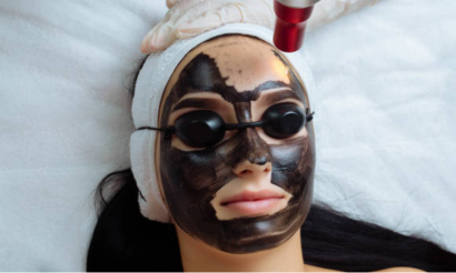 Carbon Laser Peel